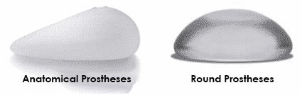 Prothèses Rondes ou Anatomiques