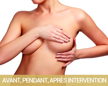 Chirurgie Esthétique du sein l'intervention augmentation mammaire