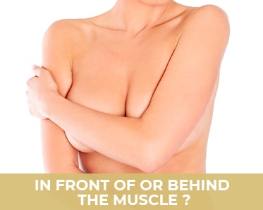 Aesthetic breast surgery intervention