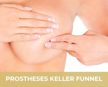 Aesthetic breast surgery intervention